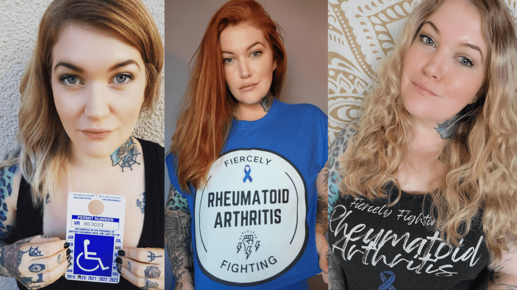 A Milestone of Resilience: Writing 100 Personal Essays About Living with Rheumatoid Arthritis