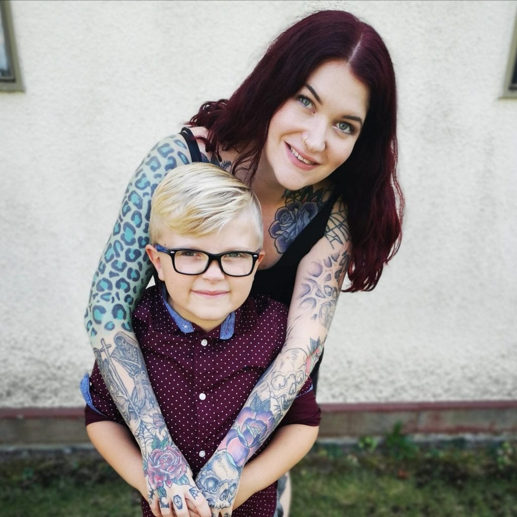Please Stop Telling Me I’m ‘Too Young’ to Have Arthritis