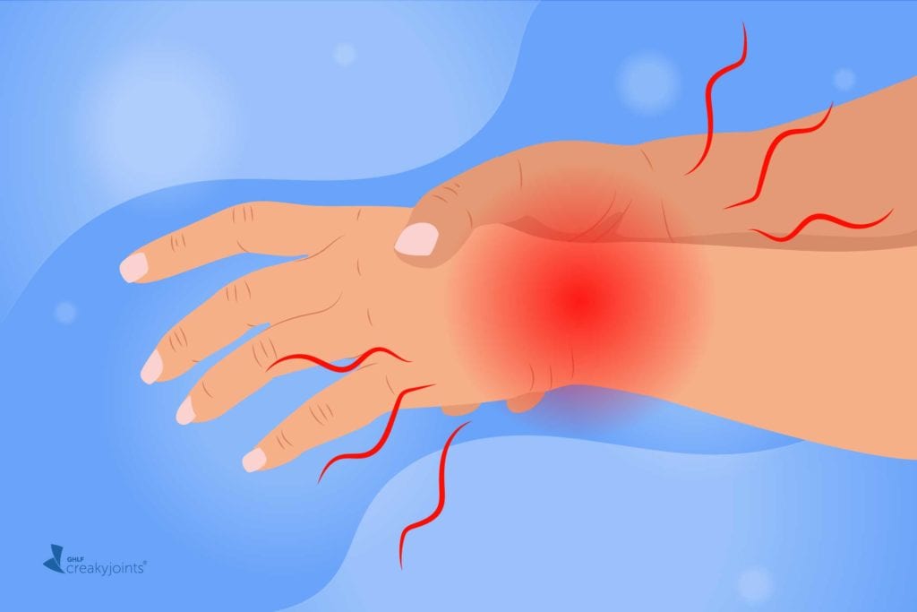 What It Means When I’m in a Rheumatoid Arthritis Flare