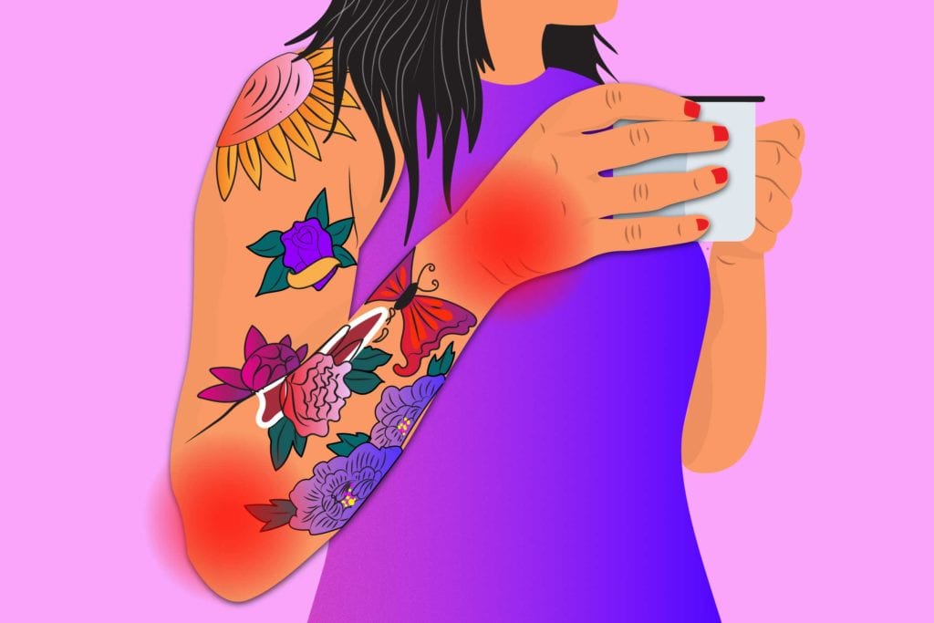 11 Questions to Ask Yourself When a Rheumatoid Arthritis Flare Is Brewing